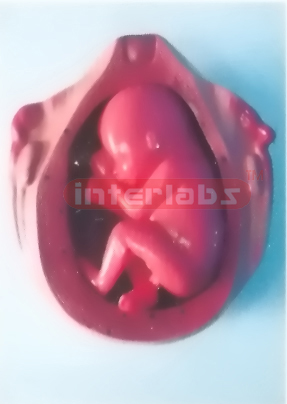 UTERUS WITH EMBRYO (6 MONTH)